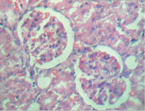 Figure 1. Severe glomerular congestion, mild glomerular edema, and mild intertubular hemorrhage (H&E staining, ×280).