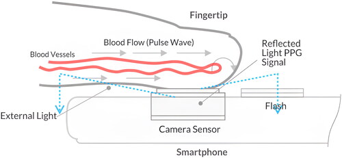 Figure 4. Fingertip on the smartphone’s camera adjacent to light source.Fluctuations of light passing through the fingertip are captured by the camera and reflect blood flow variations.Reproduced with authorization from Degott et al [Citation183].