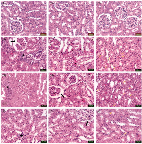 Figure 2. Photomicrographs of kidney sections stained with hematoxylin and eosin (scale bars = 20 μm), showing: (A) Group 1 (control), (B) Group 2 (CMC) and (C) Group 3 (SLY) show similarly undamaged kidney; (D) Group 4 (MTX) dilatation of Bowman’s space (arrow) and inflammatory cell infiltration (asterisk); (E) Group 4 (MTX) glomerular (arrows) and peritubular (asterisks) vascular congestion; (F) Group 4 (MTX) swelling of renal tubular epithelium cells (arrows); (G) Group 5 (MTX + CMC) inflammatory cell infiltration (asterisk); (H) Group 5 (MTX + CMC) dilatation of Bowman’s space (thick arrow) and glomerular (thin arrow), peritubular (asterisks) vascular congestion; (I) Group 5 (MTX + CMC) swelling of renal tubular epithelium cells (arrows); (J) Group 6 (MTX + CMC + SLY) inflammatory cell infiltration (asterisk); (K) Group 6 (MTX + CMC + SLY) glomerular (thin arrow) and peritubular (asterisk) vascular congestion, Bowman’s space (thick arrow); (L) Group 6 (MTX + CMC + SLY) swelling of renal tubular epithelium cells (arrows).