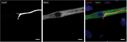 Figure 1 Cholinergic motoneurons co-localize with myotubes at day 14.