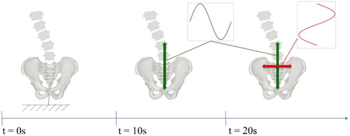 Figure 1. Imposed pelvis motion.