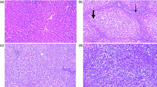 Figure 4. Histopathological examination of liver sections from normal untreated rats (a) showing normal hepatic architectecture, TAA-intoxicated (100 mg/kg) rats (b) showing severely disturbed hepatic architecture and portal tract inflammation with severe lymphocyte infiltration (thick arrow) and focal spotty necrosis (thin arrow), silymarin-treated (50 mg/kg) rats (c) showing almost normal hepatic architectural pattern with mild ballooning of hepatocytes, mild dilation of sinusoids and lymphocyte infiltration and HSARE-treated (100 mg/kg) rats (d) showing normal hepatic architecture with mild ballooning of hepatocytes and mild number of chronic inflammatory cells infiltration (H&E × 200).