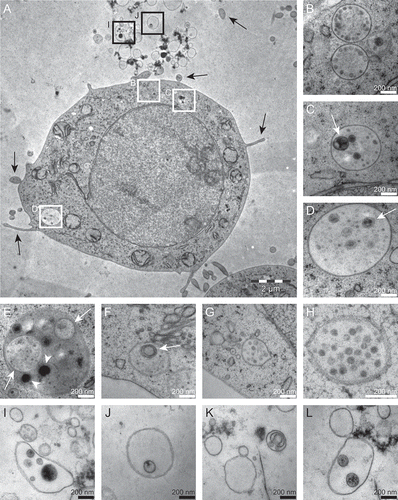 Figure 1. Thin sections showing multivesicular bodies (MVBs) contained in cultured HMC-1 cells and extracellular vesicles in the surrounding growth medium. (A) HMC-1 cell containing MVBs (white boxes) and some extracellular vesicles (EVs) in proximity to it (black boxes). The black arrows point to cell protrusions. The letters next to the boxes refer to the adjacent higher magnification panels in the figure. (B–H) MVBs in higher magnification. White arrows point to vesicles containing one or more smaller vesicles. Arrowheads point to electron-dense structures in secretory granules. (I–L) EVs at higher magnification.