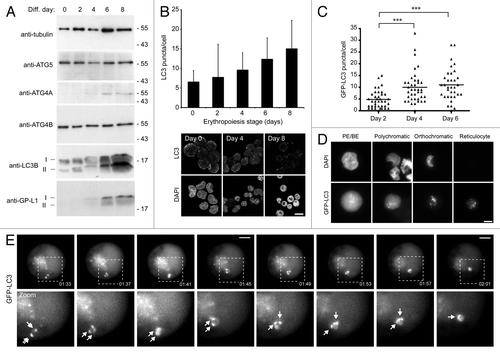 Figure 2. Induction of autophagy in differentiating human erythroid cells. (A) Immunoblots of selected autophagy proteins in staged human erythroid cultures. LC3B and GABARAPL1 (GP-LI) exist in 2 forms: soluble form I and lipid-bound form II which migrates slightly faster. TUBA/α-tubulin is included as a loading control. (B) LC3 puncta in differentiating human erythroid cells labeled with anti-LC3 antibodies. At the top, LC3 puncta counts in erythroid cells (data shown are means and s.d. of 3 independent cultures for which > 200 cells were scored). At the bottom, example images of fields of erythroid cells labeled with anti-LC3 antibodies and DAPI. Scale bar: 15 µm. (C) Quantification of LC3B puncta numbers in differentiating erythroblasts transduced with GFP-LC3B lentivirus. Cells were assessed at days 2, 4 and 6 following transfer to differentiation medium. Tukey’s multiple-comparison test: ***p ≤ 0.001. (D) Erythroid cells transduced with GFP-LC3B lentivirus, imaged by wide-field fluorescence microscopy. GFP-LC3B signal becomes progressively punctate during differentiation. Scale bar: 7.5 µm. (E) Live-cell imaging of autophagosome dynamics in a proerythroblast expressing GFP-LC3B. Arrows in zoomed images show individual autophagosomes. Scale bars: 5 µm.