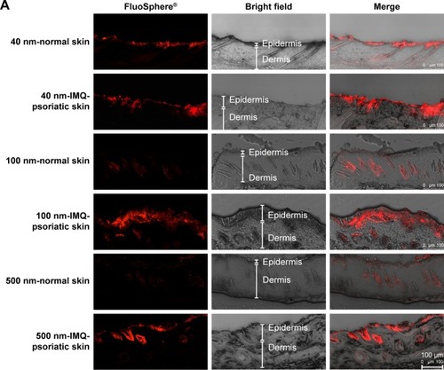 Figure 4 CLSM visualization of vertical sections from normal and imiquimod-induced psoriatic skins, which were treated with 40-, 100-, and 500-nm-sized FluoSpheres® for 24 hours at 32°C.Notes: Two views were given to present the wide structure of skin penetration (A, 200×), as well as the enlarged field of the distribution around hair follicles (B, 1,260×). For picture A, bar =100 µm, while for picture B, bar =25 µm. The emission wavelength was between 590 and 656 nm for 40 and 100-nm-sized FluoSphere® when the excitation wavelength was set as 552 nm, while the emission wavelength was between 495 and 545 nm for 500-nm-sized FluoSphere® when the excitation wavelength was set as 488 nm. The white arrows indicate the hair follicles.Abbreviations: CLSM, confocal laser scanning microscopy; IMQ, imiquimod.