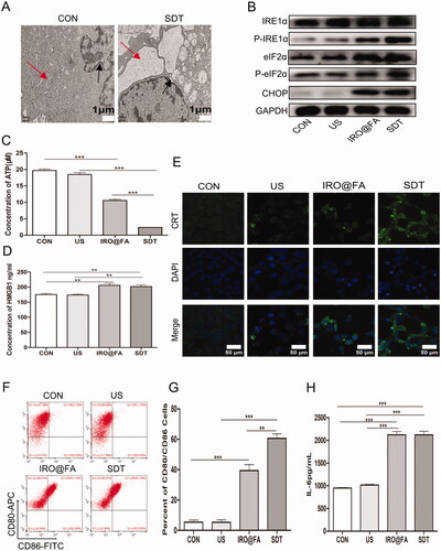 Figure 6. IRO@FA NPs induced secretion of DAMPs and prompted DCs activation in vitro. (A) after exposure to SDT, cells were processed for TEM, the morphology of ER was observed. The red arrow represented ER. The black arrow represent perinuclear space; (B) after treated with NPs and SDT for 24 hours, cells were subjected to western blot analyzing using the indicated antibodies, GAPDH was used as loading control; (C) cells were treated as above and retained amount of ATP was determined; (D) the concentration of HMGB1 in cell supernatants were determined with ELISA; (E) calreticulin on cell membrane were detected with immunofluorescence and observed by LSCM; (F) DCs from C57/BL6 mice were cultured in vitro and incubated with different cell supernatants, proportion of activated DCs were counted by flow cytometry (gated on negative control); (G) showed quantification analysis of (F); (H) the concentration of IL-6 in supernatants from DCs treated with different conditions were analyzed by ELISA; *p < .05; **p < .01; ***p < .001.