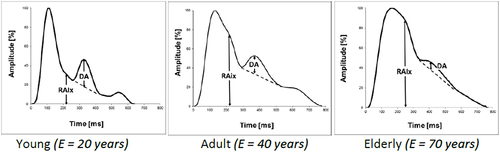 Figure 2 Effects of aging in healthy individuals. With increasing age, the systolic wave widens, and the oscillation amplitude flattens.