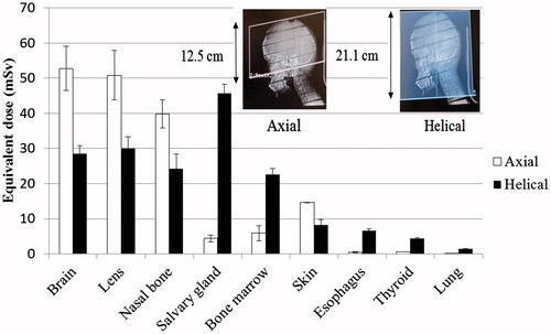 Figure 3. Equivalent doses of organs or tissues (mSv) of the two protocols: The bar presents counting errors.