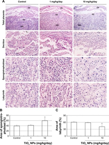 Figure 4 Effect of TiO2 NP exposure on placental histopathology.Notes: (A) Representative images of placental section observed by H&E staining. Scale bar, 50 μm. (B) The ratio of spongiotrophoblast/total area of placenta (%). (C) The ratio of labyrinth/total area of placenta (%). Data are represented as means ± SEM of 10 animals. *P<0.05 compared with control.Abbreviations: TiO2 NPs, titanium dioxide nanoparticles; H&E, hematoxylin and eosin; SEM, standard error of mean; de, decidua; sp, spongiotrophoblast; lab, labyrinth.