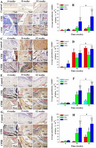 Figure 7 Immunohistochemistry staining for (A) alkaline phosphatase (ALP), (C) type I collagen (COL1), (E) osteocalcin (OC), and (G) osteopontin (OPN) of bone defects at 4–12 weeks post implantation in rabbits. (B), (D), (F), and (H) Show the quantitative data from (A), (C), (E), and (G), respectively. Data display the mean relative values calculated from three independent experiments (mean ± SD). * p < 0.05; ** p < 0.01; * is the significance compared to defect control, # p < 0.05; is the significance compared to CPH group. Scale bar = 100 µm.Abbreviations: NB, new bone; F, fibrous tissue.