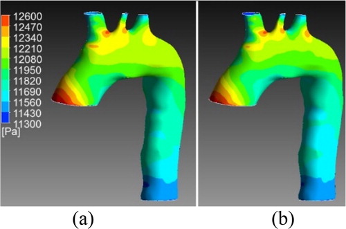 Figure 2. Pressure wall at systole for one validation case. a) Results from the simulation b) Results from the ROM.