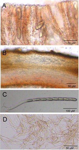 Figure 3. Light field light micrograph of Microstoma ningshanica. A: hymenium; B: ectal excipulum and medullary excipulum; C: asci and ascospore; D: paraphyses.