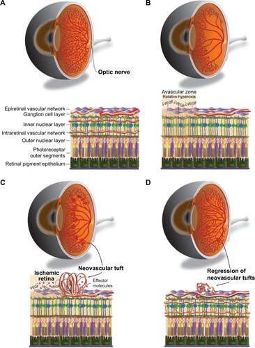 Figure 1 Murine retinal vascular changes during OIR.