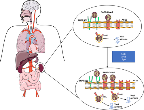 Figure 3 The possible mechanistic pathway of acute renal injury in hypertensive patients with COVID-19.