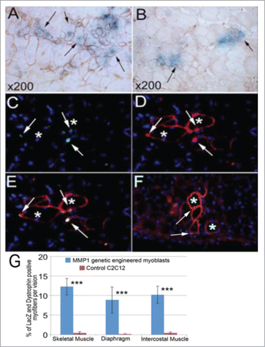 Figure 6. Systemic delivery through tail vein and cell migration assays. In the tail vein injected mice, we detected large number of LacZ positive cells in the liver tissue (not shown) of injection with both genetic and control C2C12 myoblasts. However, we found more LacZ positive myofibers in the skeletal muscle of genetically engineered C2C12 myoblasts injected mice (A) compared to the control C2C12 myoblasts injected mice (B). With dystrophin immunostaining, we also confirmed that most of the dystrophin positive myofibers also expressed LacZ (A and B), but the dystrophin positive myofibers were smaller and fewer in the muscle of control cell injection (B) compared to genetic myoblasts injected mice (A). We also detected some β-gal (LacZ) (C and E) and dystrophin positive myofibers (D and E) in the diaphragm, and in the intercostal muscle (F) of the genetic myoblast injected mice, but no similar discovery was found in the control injected mice. The general measurement of LacZ positive and dystrophin expressed myofibers indicated the significance of cell migration capacity within the genetically engineered myoblasts (G). (***P < .001).