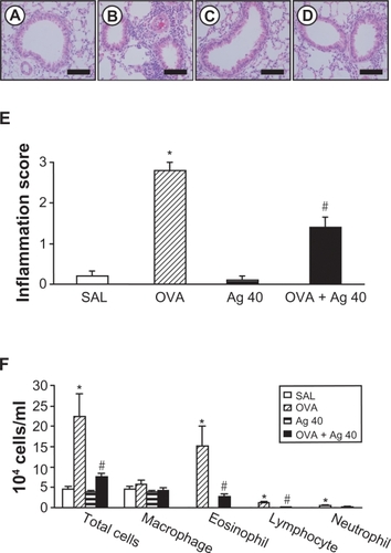 Figure 5 Effect of silver nanoparticles (NPs) on bronchial inflammation in ovalbumin (OVA)-sensitized and OVA-challenged mice. Sampling was performed 72 hours after the final challenge in saline-inhaled mice administered saline (SAL), OVA-inhaled mice administered saline (OVA), saline-inhaled mice administered 40 mg/kg of silver NPs (Ag 40), and OVA-inhaled mice administered 40 mg/kg of silver NPs (OVA + Ag 40). A−D) Representative H&E-stained sections of the lungs. Bars indicate scale of 50 μm. E) Total lung inflammation scores. F) The numbers of total and differential cellular components of bronchoalveolar lavage (BAL) fluids. Bars indicate the mean ± SEM for eight mice per group in four to six independent experiments. *P < 0.05 versus SAL; #P < 0.05 versus OVA.