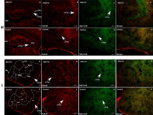 Figure 5 (A) c-Fos expression is upregulated in SGLT-2i group (A, B, C, D) vs control group (E, F, G, H) as determined by immunofluorescence assay in MnPO (A); PVA (B); PVN (C); SC (D); PAG (E); LC (F); NTS (G); CA3 (H); Me (I); Red: Alexa Fluor-594, staining showing c-Fos expression in nucleus of neurons; Green: Alexa Fluor-488, staining showing SGLT-2 expression surround nucleus of neurons; Scale bar: 100μm. Magnification: A and E=5X; B, C, D and F, G, H=20X.Abbreviations: MnPO, median preoptic nucleus; ac, anterior commissure; PVA, paraventricular thalamic nucleus; D3V, dorsal 3rd ventricle; PVN, paraventricular hypothalamic nucleus; 3rdV, 3rd ventricle; SC, superior colliculus; Aq, aqueduct; PAG, periaqueductal gray; Aq, aqueduct; LC, locus coeruleus; 4V, 4th ventricle; AP, area postrema; NTS, nucleus of solitary tract; CC, central canal; D3V, dorsal 3rd ventricle; CA3, the field CA3 of hippocampus; Me, medial amygdala nucleus; Ce, central amygdala nucleus; BMA, basomedial amygdala nucleus; BLA, basolateral amygdala nucleus; Pirl, piriform cortex.