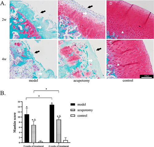 Figure 3 (A) 1–6: Safranin O/fast green staining. The black arrow points to cartilage damage, the white arrow points to the discoloration of the matrix, the triangle marks the position of the tide line. All pictures use the scale in the image ⑥. (B) Mankin scores show that the morphology of cartilage is better in the acupotomy group, and the model group progressed more severely over time. Compared with the control group during the same time period, *P is < 0.05; Compared with the model group during the same time period, ΔP is < 0.05.