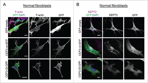 Figure 2. A Cdc42-defective binding mutant of Cdc42EP3 presents a diffuse pattern of cytosolic localization and does not induce actin and septin rearrangements in normal fibroblasts. (A) Panels show GFP (green), F-actin (magenta) and DAPI (blue) staining of normal fibroblasts following transfection with GFP or GFP-tagged wild-type (wt) or IS mutant (IS) Cdc42EP3 (CEP3) proteins. The grayscale panels show individual channels for F-actin and GFP. Scale bars, 25 μm. (B) Panels show GFP (green), SEPT2 (magenta) and DAPI (blue) staining of normal fibroblasts following transfection with GFP or GFP-tagged wild-type (wt) or IS mutant (IS) Cdc42EP3 (CEP3) proteins. The grayscale panels show individual channels for F-actin and GFP. Scale bars, 25 μm.