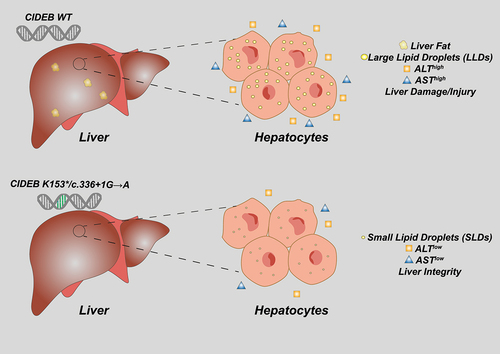 Figure 1. CIDEB gene variants correlate with liver health.