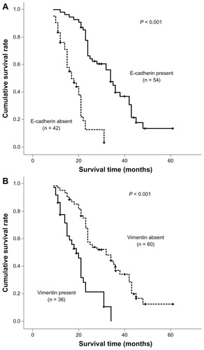 Figure 2 Survival analysis of three epithelial-mesenchymal transition markers in univariate analysis using the Kaplan-Meier method determined by the log-rank test. E-cadherin loss (A) and upregulation of mesenchymal proteins vimentin (B) and N-cadherin (C) were found to be significantly associated with a poor outcome. There was also a trend toward coexistence of multiple epithelial-mesenchymal transition markers (D and E) associated with much more shorter overall survival.