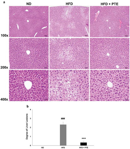 Figure 4. Treatment with PTE attenuated HFD-induced liver lesion. Comparison of histopathological alterations of the liver in the ND, HFD control, and PTE groups. (a) Tissue sections were prepared and stained with hematoxylin and eosin. The sections were photographed at 100×, 200×, and 400× magnifications. Scale bars = 100, 50, and 20 μm at each magnification, respectively. (b) Quantification of liver lesion histology. Significant differences between ND and HFD group are indicated by ###p < 0.001; HFD and PTE group are indicated by ***p < 0.001.