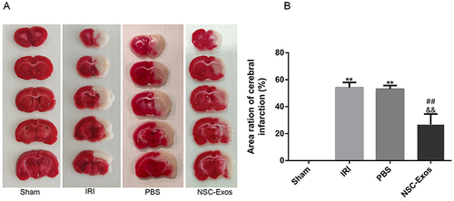 Figure 3 Effects of NSC-Exos on cerebral infarct size in rats after MCAO. The brain tissue of normal rats was red, without obvious infarct areas, and the structure was well symmetric. Injured rats showed obvious white infarcts. After NSC-Exos treatment, the infarct size was reduced, and a small part of white infarcts were seen. (A) Representative cerebral infarcts stained with TTC solution. (B) Quantitative analysis of infarct size. Administration of NSC-Exos reduced the infarct size. Calculated as: Infarct size (%) = (contralateral hemisphere area - ipsilateral non-infarct area) / contralateral area × 100% (**P<0.01 vs Sham group; ##P<0.01 vs IRI group; &&P<0.01 vs PBS group).
