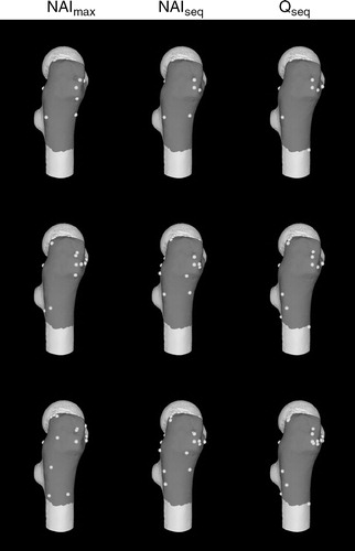 Figure 5. Proximal femur surface model and registration points generated using the point-selection algorithms. From top to bottom are point sets of size 9, 18, and 30.