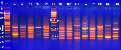 Figure 5 DNA fingerprint profile generated by RAPD-PCR for A. baumannii clinical isolates. L1 and L2, represent 100 bp and 1 kb DNA ladders, respectively that were supplied from Solis BioDyne, Estonia. Lanes 94 to 99 and 100 to 110 represent the isolate number.