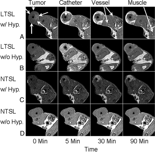 Figure 3. MRI axial image results of rats with transplanted flank fibrosarcomas treated with (A) low temperature thermosensitive liposomes with HT, (B) unheated low temperature thermosensitive liposomes, (C) non-thermosensitive liposomes with HT, and (D) unheated non-thermosensitive liposomes from 0–90 min. The flank tumor is indicated along with the heating catheter, venous vessels, and unheated muscle. Reprinted with permission from Citation[34].