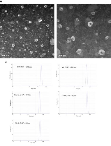 Figure 1 Characterization of vit. D-NPs and size distribution by transmission electron microscope (TEM) and differential light scattering (DLS). (A) TEM images show that vit. D–NPs are spherical in shape and sub-200 nm in size. (B) Hydrodynamic diameters of all liposome formulations were measured by DLS.