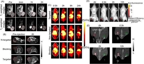 Figure 2 (A) T1- and T2-weighted MR imaging of tumors with Fe3O4@Mn3O4 NPs. Reprinted from Kim MH, Son HY, Kim GY, Park K, Huh YM, Haam S. Redoxable heteronanocrystals functioning magnetic relaxation switch for activatable T1 and T2 dual-mode magnetic resonance imaging. Biomaterials. 2016;101:121–130.Citation66 Copyright © 2016, with permission from Elsevier. Serial coronal T1-MRI imaging (B) and PET images (C) of 4T1 tumor-bearing mice after injection of 64Cu-NOTA-Mn3O4@PEG-TRC105, 64Cu-NOTA-Mn3O4@PEG, or 64Cu-NOTA-Mn3O4@PEG-TRC105 after a preinjected blocking dose of TRC105. Reproduced from Zhan Y, Shi S, Ehlerding EB, et al. Radiolabeled, Antibody-Conjugated Manganese Oxide Nanoparticles for Tumor Vasculature Targeted Positron Emission Tomography and Magnetic Resonance Imaging. ACS Appl Mater Interfaces. 2017;9(44):38304–38312.Citation1Citation32 Copyright © 2017 American Chemical Society. In vivo fluorescence imaging (D) and T1-MR imaging (E) of lymph nodes with Mn3O4@PEG-Cy7.5 NPs in BALB/c mice at different post-injection time points. Reprinted from Zhan Y, Zhan W, Li H, et al. In Vivo Dual-Modality Fluorescence and Magnetic Resonance Imaging-Guided Lymph Node Mapping with Good Biocompatibility Manganese Oxide Nanoparticles. Molecules. 2017;22(12):2208.70Abbreviations: Pre, pre-injection; Imm, immediate; N-targeted, non-targeted.