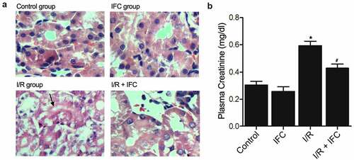 Figure 1. IFC-305 treatment prevented I/R induced kidney injury (* P value < 0.05, vs control group; # P value < 0.05, vs. I/R group). A: H&E staining showed an increased level of renal injury in I/R rats, while the IFC-305 treatment alleviated the severity of I/R-induced renal injury (magnification, x200; arrow denotes injured renal tubules). B: The level of creatinine was increased in I/R rats and reduced by IFC-305 treatment.