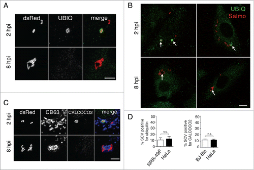 Figure 4. Selective autophagy of LGP+ membranous aggregates differs from Salmonella xenophagy. (A to C) Confocal microscopy images showing that ubiquitin (A, B) and CALCOCO2 (C) decorate damaged Salmonella-containing vacuoles (SCV) at 2 hpi but are not detected at 8 hpi in the LGP+ membranous aggregates. Panel B, in which the fluorescence signal was processed to appear with higher intensity, shows ubiquitinated components in the entire cell. Arrows indicate intracellular bacteria. Ubiquitin was detected in NRK49F rat fibroblasts whereas CALCOCO2 was detected in BJ-5ta human fibroblasts. Bacteria (dsRed); Ubiquitin (UBIQ). Scale bars: 5 μm (A, (C)panels), 10 μm (B panel). (D) Percentage of ubiquitin- and CALCOCO2-positive SCV in fibroblasts and epithelial cells quantified at 2 hpi by epifluorescence microscopy. Data are the means and standard deviations from 3 independent experiments. n.s., not significant (Student t test).