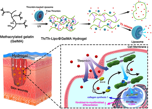 Figure 2 Anatomical and molecular mechanisms of Th and Th-Lipo-loaded GelMA hydrogel repairing and regenerating diabetic skin. Reprinted from Chemical Engineering Journal, 397, Wang C, Wu T, Liu G, et al. Promoting coagulation and activating SMAD3 phosphorylation in wound healing via a dual-release thrombin-hydrogel, 125414, Copyright © 2020, with permission from Elsevier B.V.Citation101