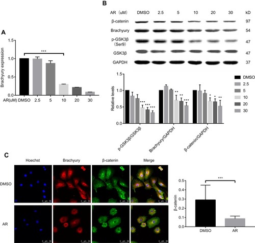 Figure 2 AR-A014418 (AR) decreased the expression level of brachyury in chordoma cells involving Wnt/β-catenin signaling pathway. (A) After treatment of chordoma cells with serial dilutions of AR (2.5–30 μM) or DMSO (as control), brachyury mRNA was isolated and quantified by qRT-PCR. (B) After treatment with DMSO (as control) or AR at the indicated dose, the protein expression was assessed by Western blotting and quantified with Image J. (C) After AR (30 μM) or DMSO (as control) treatment, the chordoma cells were stained and observed under a confocal microscope. DMSO, dimethyl sulfoxide. *p<0.05, **p< 0.01, ***p< 0.001.