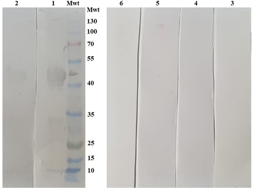 Figure 4. Validation of the purified recombinant SARS-CoV-2 nucleocapsid protein cross reactivity and specificity using Western blot analysis. Nucleocapsid-6×His protein was loaded on 10% SDS gel, transferred onto 0.22 mm PVDF membrane, and tested against human sera previously collected and stored from patients infected with Hepatitis C virus. Lanes 1 and 2 are two SARS-CoV-2 positive sera, lanes 3 and 4 are two SARS-CoV-2 negative sera, and two hepatitis C positive sera in lanes 5 and 6.