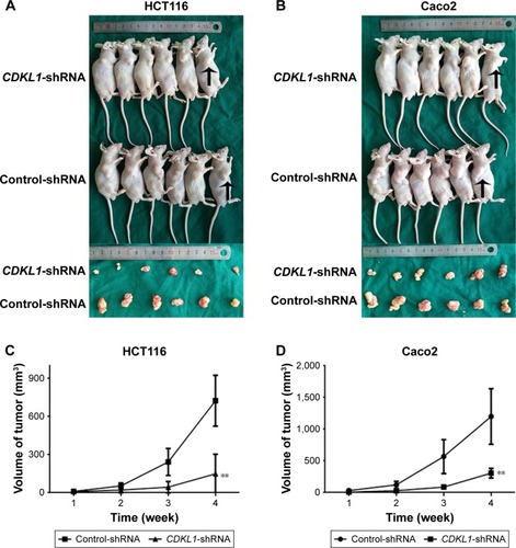 Figure 4 CDKL1 knockdown inhibits colon tumorigenesis in vivo.