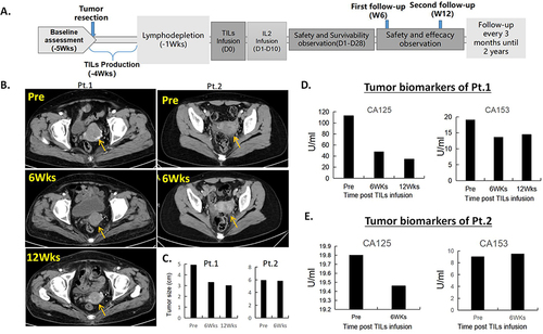 Figure 1 Trial design and efficacy evaluation. (A). Trial design and timeline of the study. (B). Enhanced pelvic CT scans of patient 1 at pre-TILs infusion, 6 weeks, and 12 weeks post treatment showed a targeted lesion of 4.9cm, 3.3cm, and 3.0cm, respectively, suggesting a rapid tumor shrinkage. CT scans of patient 2 at pre-TILs infusion and 6 weeks post treatment showed a targeted lesion of 5.9cm and 5.8cm, respectively, showing a stable disease. (C). Tumor size measurements of the two patients before and after treatment. (D and E). Levels of serum biomarkers CA125 and CA153 of the two patients decreased after TILs infusion suggesting that their disease were in control.