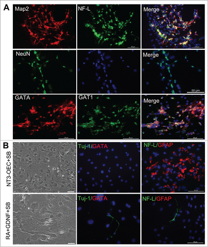 Figure 4. Generation of GABAergic neurons from fibroblasts with the combination of the conditioned medium of NT3-OECs, plus SB431542, GDNF and RA. (A) Immunostaining of the MEF-derived cells at 3 weeks post-induction with Map2, NF-L, NeuN, GATA and GAT1 antibodies. (B) Phase-contrast microscopic of MEF-derived cells and double staining of MEF-derived cells with GATA/Tuj1 or NF-L/GFAP when the MEFs were cultured with the combination of NT3-OECs with SB431542 (SB) or 1% B27 medium supplemented with SB, GDNF and RA for 3 weeks. scale bar, 50 μm.