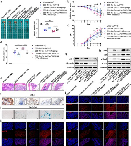 Figure 8. Fn-Exo exacerbates experimental colitis by activating the ATM/ATR/p53 pathway via the miR-129-2-3p/TIMELESS axis. (a-d) Representative morphology and length of colons (a), body weight loss (b), DAI (c), and histological score (d) of experimental colitis mice in 5 different treatment groups (n = 8). (e) H&E staining of mouse colon cross-sections after different treatments. Scale bar = 50 μm. (f) Representative images of IHC staining of ZO-1 in mouse colon cross-sections. Scale bar = 20 μm. (g) Immunoblot analysis was conducted to assess the expression of ZO-1 and Occludin using proteins extracted from colon tissues. GAPDH was used as an internal control. (h) Western blotting analysis of p53, p21, γH2AX, and H2AX in mice colon tissues. (i) SA-β-Gal staining of mouse colon cross-sections. Scale bar = 20 μm. (j-l) Representative immunofluorescence images showing the expression and distribution of p-ATM (red, j), p-ATR (red, k), and p-p53 (red, l) in mouse colonic epithelium. Nuclei were stained blue using DAPI. Scale bar = 20 μm. Data are represented as means ± SEM. **p < 0.01, ***p < 0.001, ****p < 0.0001.