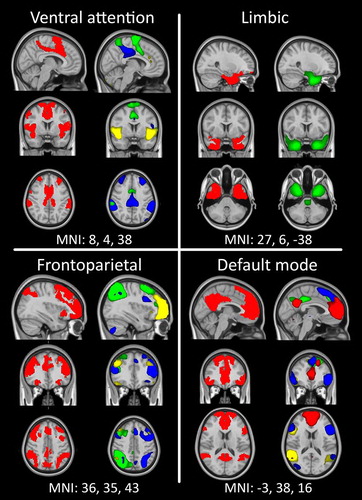 Figure 1. Reference networks (Yeo et al., Citation2011) are well matched to resting-state networks used in the current study. The reference network is plotted on the left in red, while individual ICs (significantly overlapping with that reference network) are plotted in contrasting colours within a single image on the right. All overlays are thresholded at 3 < z < 6.