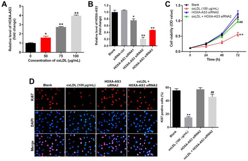 Figure 1 OxLDL-induced growth inhibition of HUVECs was significantly reversed by HOXA-AS3 knockdown. (A) HUVECs were treated with 0, 50, 75 or 100 μg/mL oxLDL for 48 h. Then, the expression of HOXA-AS3 in HUVECs was detected by RT-qPCR. (B) HUVECs were transfected with HOXA-AS3 siRNA1, siRNA2 or siRNA3 for 24 h. Then, the expression of HOXA-AS3 in HUVECs was measured by RT-qPCR. (C) HUVECs were treated with oxLDL (100 μg/mL), HOXA-AS3 siRNA2 or oxLDL + HOXA-AS3 siRNA2 for 0, 24, 48 or 72 h. The viability of HUVECs was detected by CCK-8 assay. (D) The proliferation of HUVECs was detected by Ki67 staining. The Ki67 positive rate was calculated. Red immunofluorescence indicated Ki67. Blue immunofluorescence indicated DAPI. *P< 0.05 compared to control, **P< 0.01 compared to control, ##P< 0.01 compared to oxLDL (100 μg/mL); n = 3.