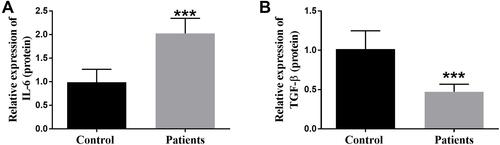 Figure 1 The expression levels of IL-6 (A) and TGF-β (B) in controls and patients serum were measured by enzyme-linked immunosorbent assay. ***P < 0.001 versus the Control groups.