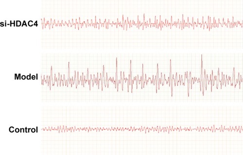 Figure 4 si-HDAC4 inhibits the occurrence of epilepsy using electroencephalogram.