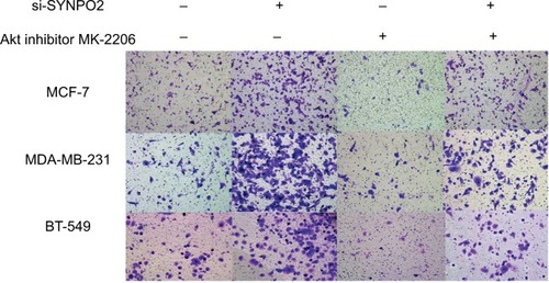 Figure 7 Transfection with Akt inhibitor MK-2206 could partly rescue SYNPO2-mediated migration.Notes: Transfection with Akt inhibitor MK-2206 prevented SYNPO2-induced migration. Magnification 20×.Abbreviation: SYNPO2, synaptopodin 2.