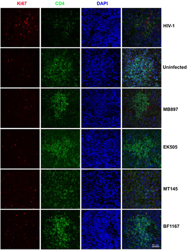 Fig. 5 Immune activation in splenic tissues of SIVcpz- and HIV-1-infected hu-BLT mice detected using immunofluorescent staining of human CD4 and Ki67.Human CD4+ T cells are shown in green, human Ki67+ cells in red, and DAPI in blue. Each row is labeled by the virus strain used for infecting the animals. Scale bar, 50 µm
