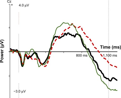 Figure 2 ERP component IC CNV late for SE group (thick black line), no-SE group (red dotted line), and normal controls (thin green line). At 1,100 ms after stimulus 1: controls, −2.92 μV; SE group, −2.35 μV; no-SE group, −0.98 μV.