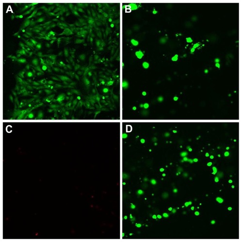 Figure 8 Live/dead staining using calcein AM and ethidium homodimer 1 of osteoblast grown within gellan xanthan gels after 48 hours, (A) gel extract, (B) live cells within the gel, (C) dead cells within the gel, (D) merged image (B and C).