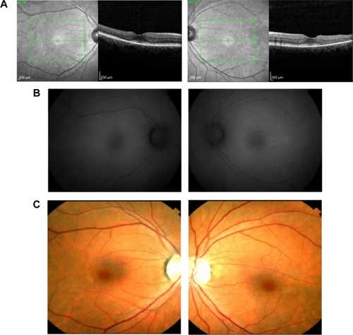 Figure 1 Case 1.